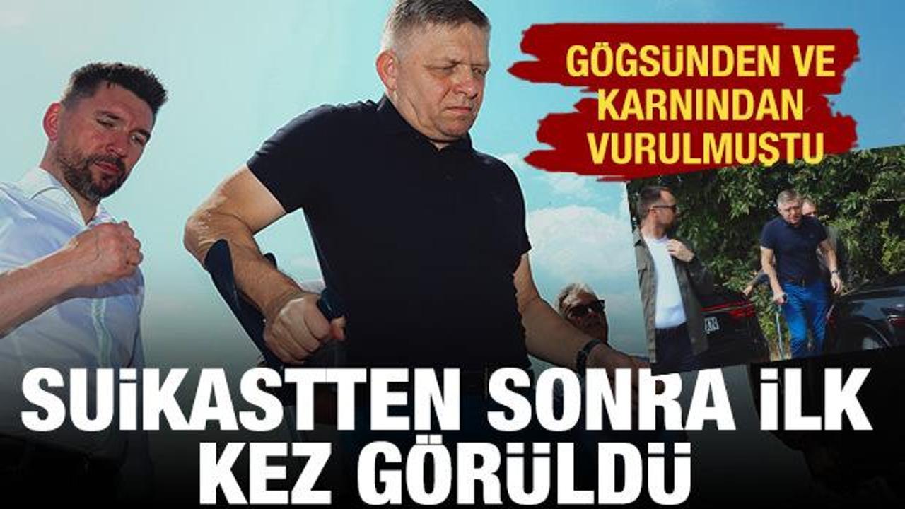 Fico suikastten sonra ilk kez kamuoyu karşısına çıktı
