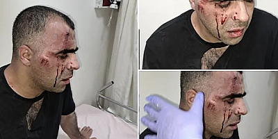 Gazeteciye belediye başkanı korumalarından sen misin yazan dayağı...
