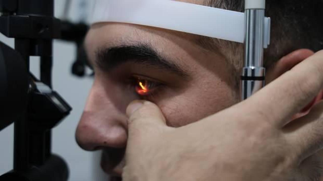 Gözlerde hasar bırakan virüse dikkat! Tedavi edilmezse ömür boyu izi kalıyor