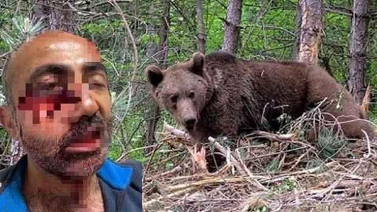 Hakkari'de ayı saldırısı: Yüzü ve çenesi parçalandı